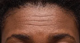 Fine Lines
