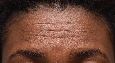 Fine Lines