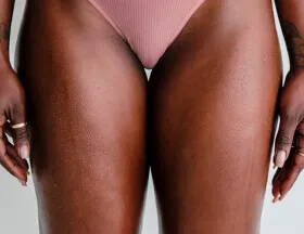 Inner Thigh Dark Spots