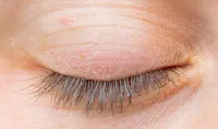 Short Lashes