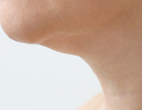 Turkey Neck