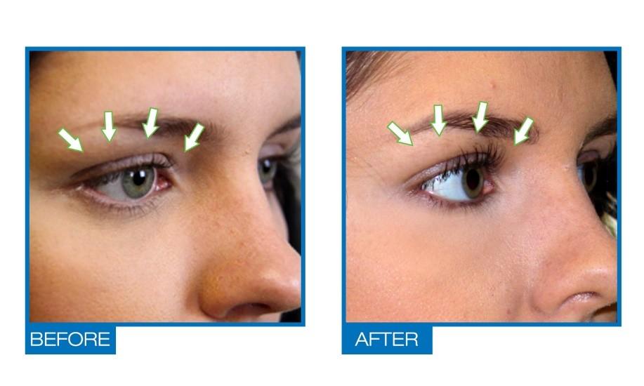 Omiera Labs Revimour Natural Eyelash and Eyebrow Growth Serum - image 2