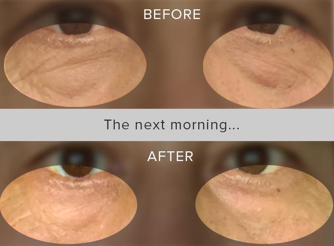 Hydrogel Eye Mask - Bye Bye Eye Bags - image 3
