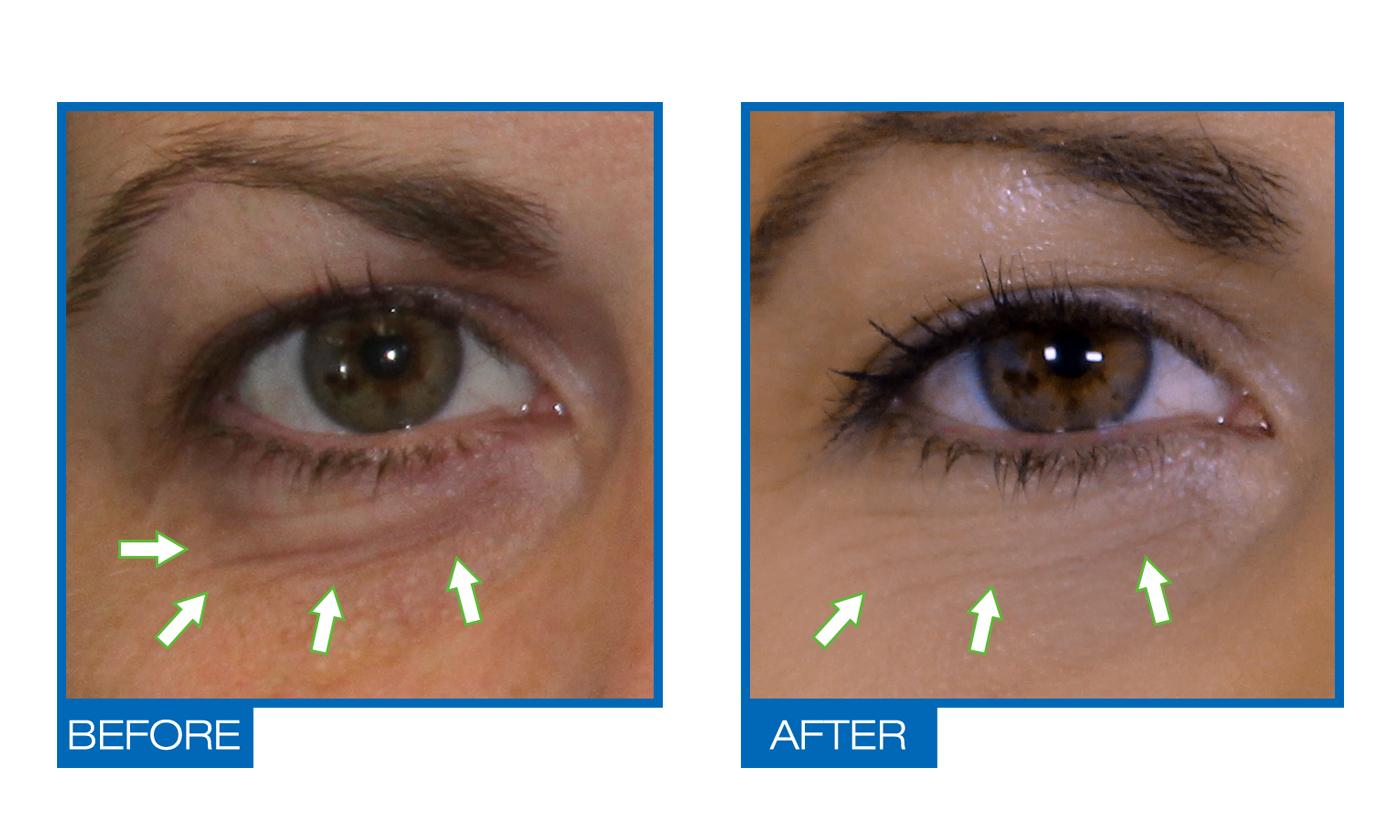 Omiera Labs Illumizone Dark Circles & Facial Brightening Serum - image 2
