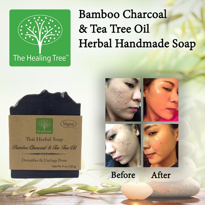 Bamboo Charcoal & Tea Tree Oil Handmade Soap for Acne Prone Skin by The