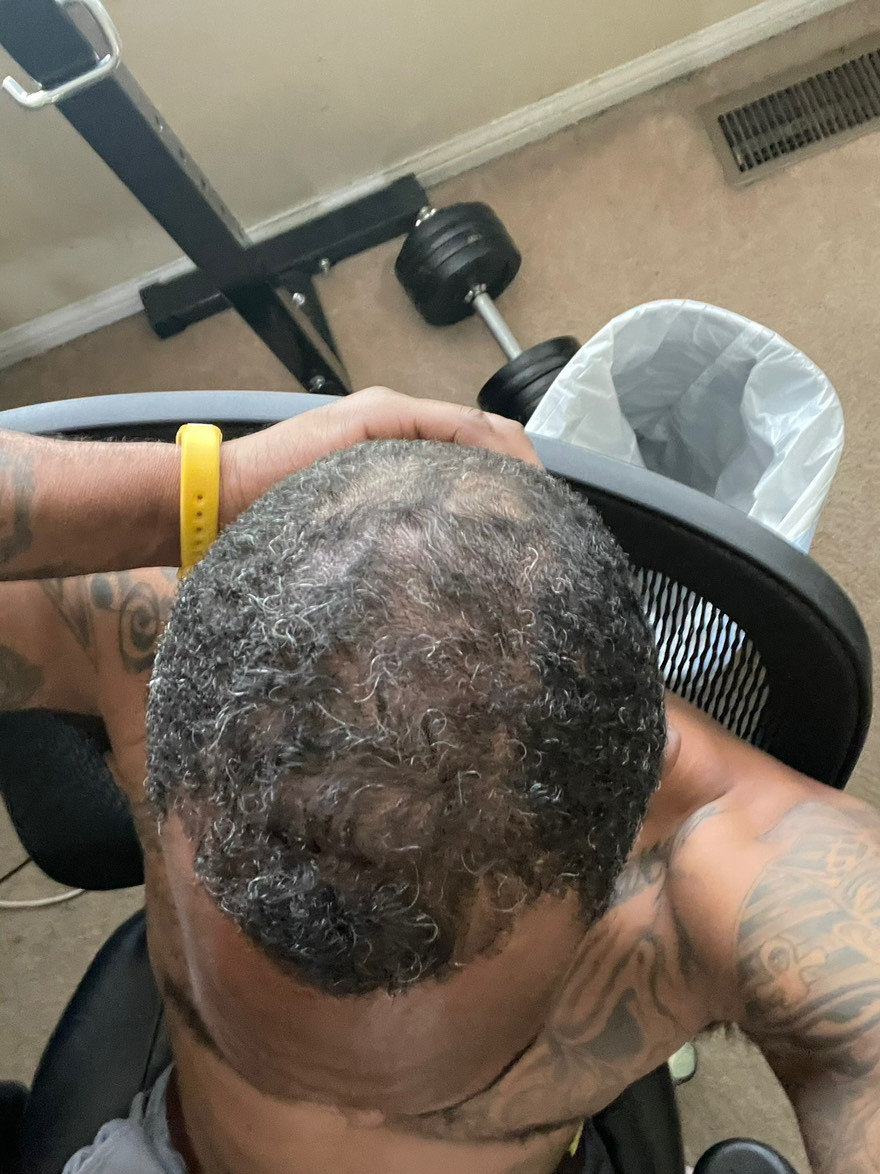 The Hair Topical Solution - Classic review photo by Kedrick H.