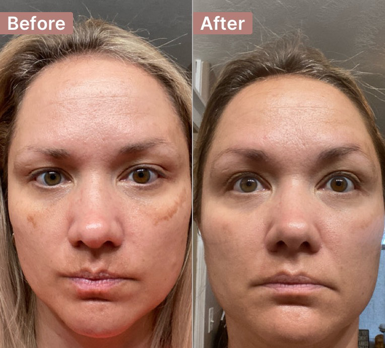 The Spot Cream review photo by Lindsey S.