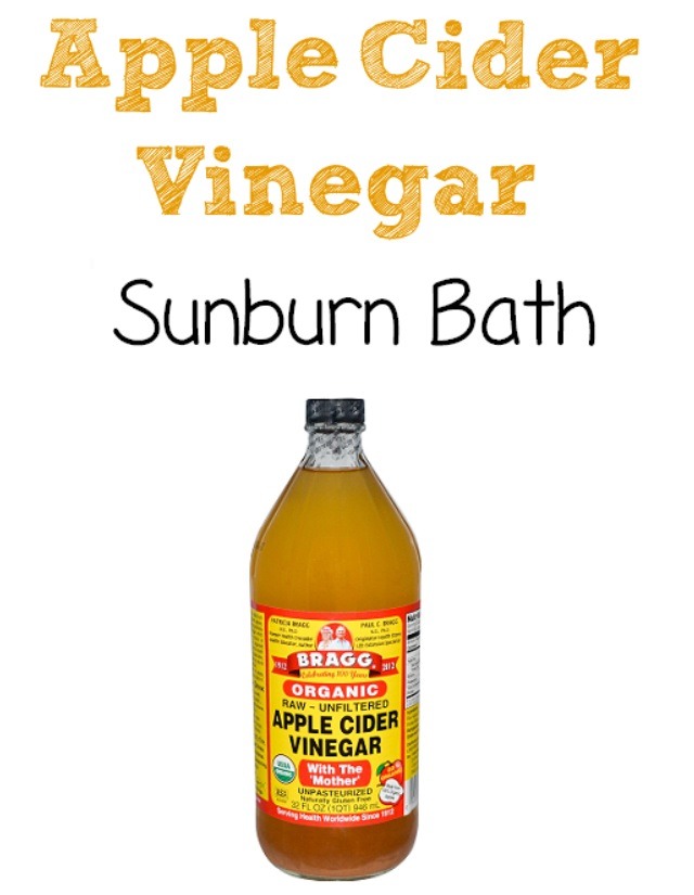 ️☀️🍎Apple Cider Vinegar Sunburn Relief (Sunburn Bath) Musely