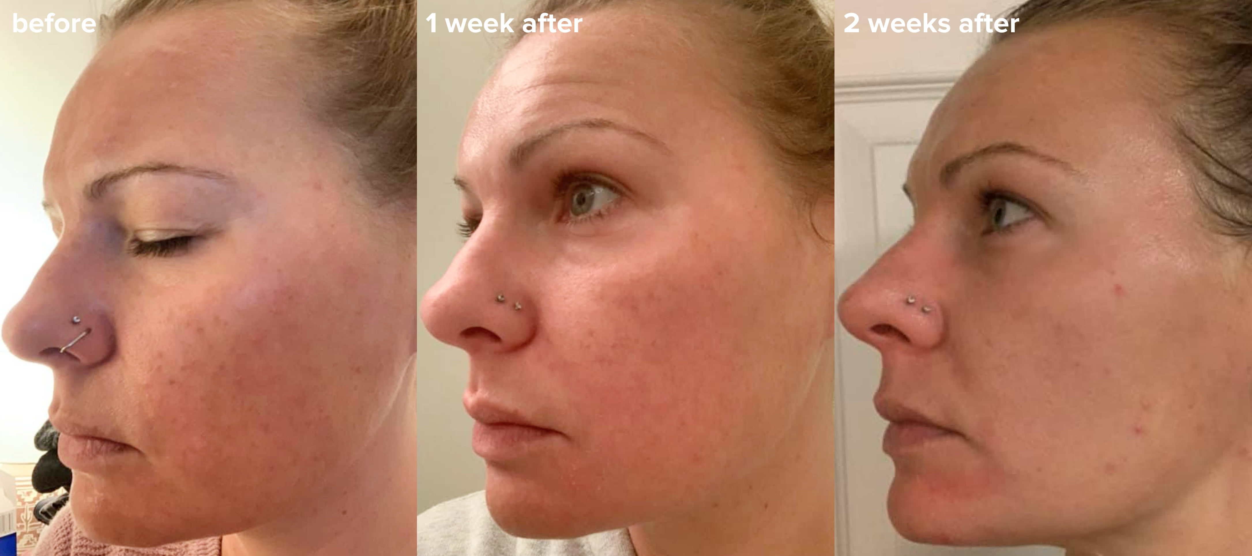 Before and after review photo