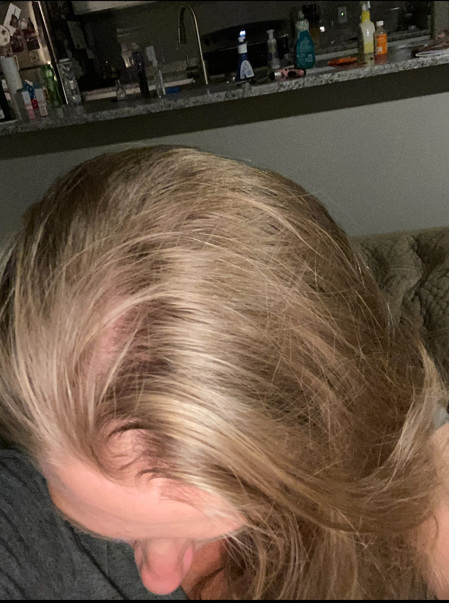 The Hair Pill review photo by Jolene S.