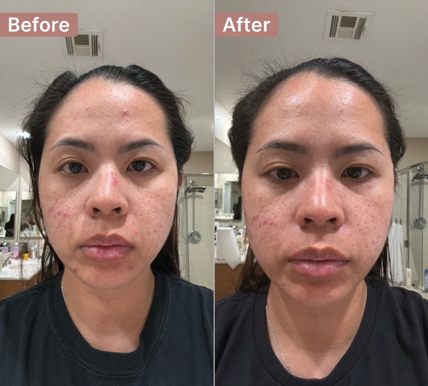 The Spot Cream review photo by Alexandra Z.