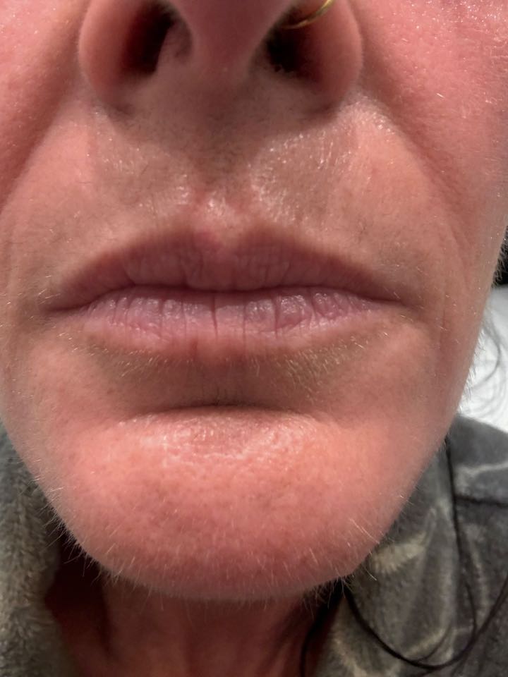 Customer photo