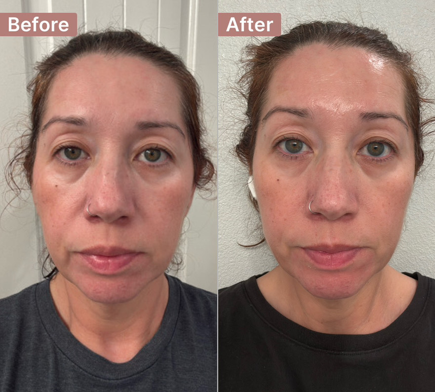 The Eye Serum review photo by lily T.