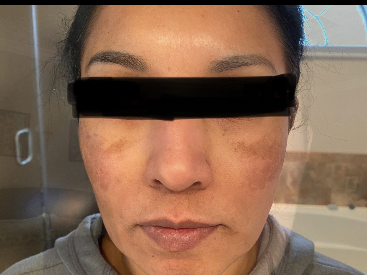 Customer photo