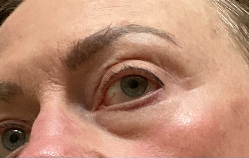 The Eye Serum review photo by Rebecca M.