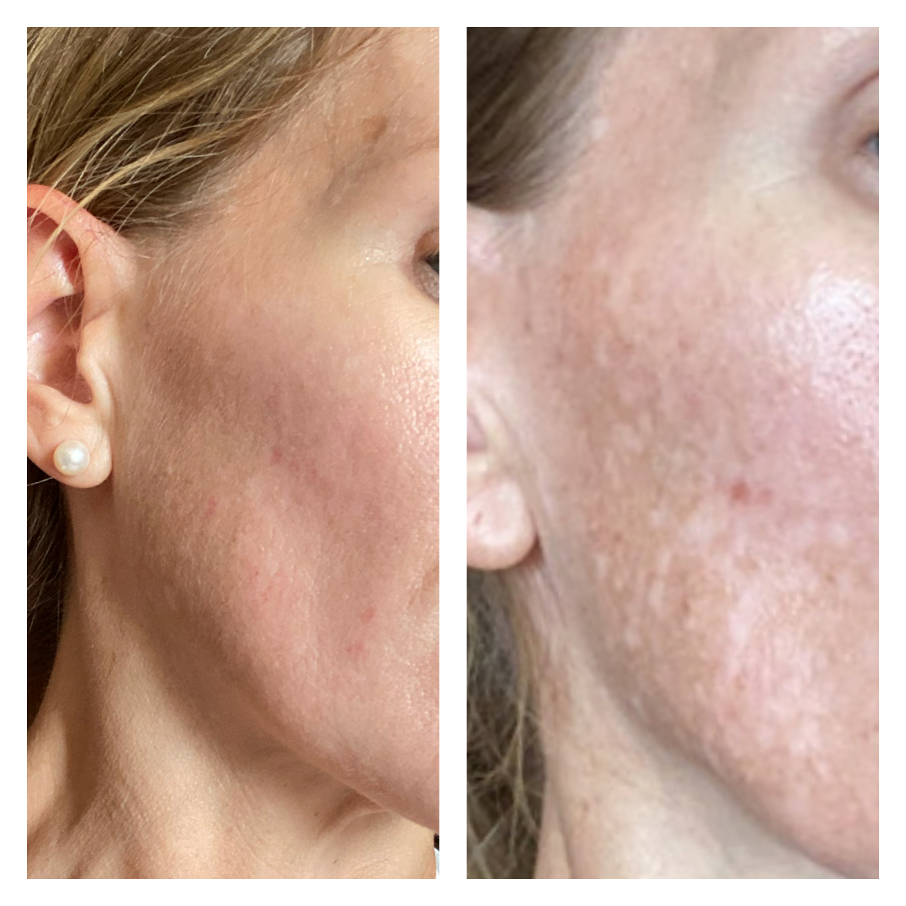 The Spot Cream review photo by Cindy E.