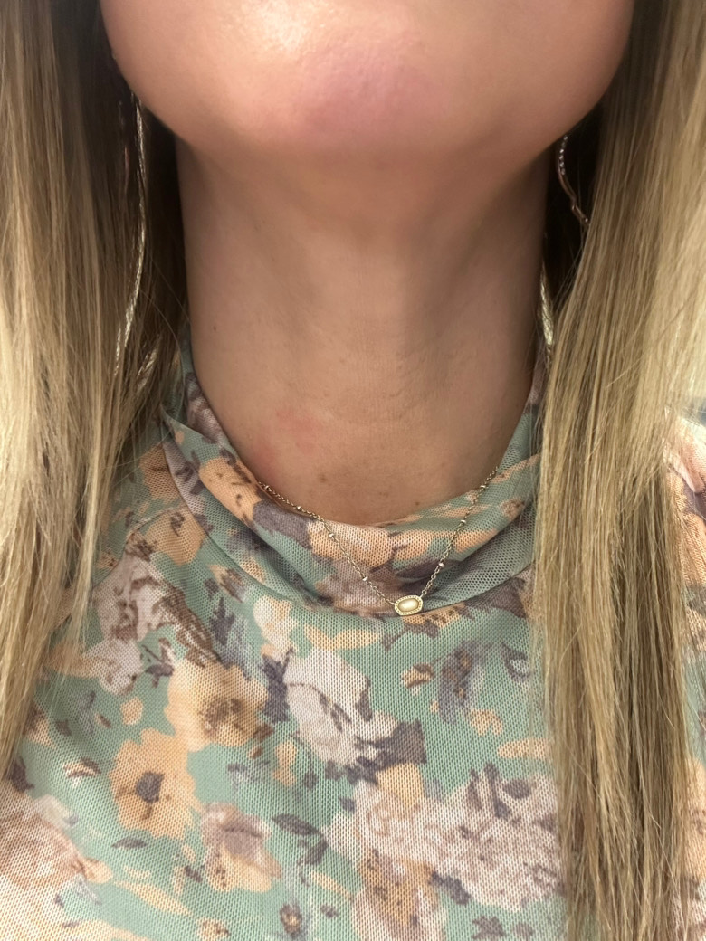 Customer photo