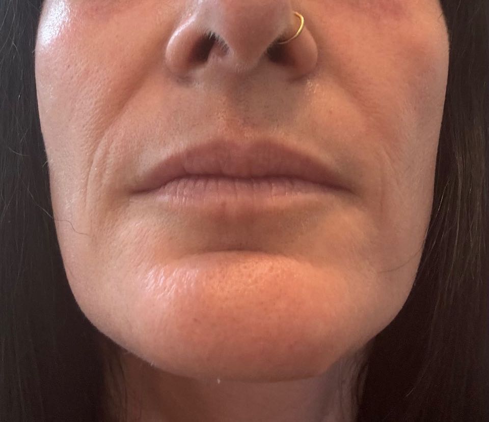 Customer photo