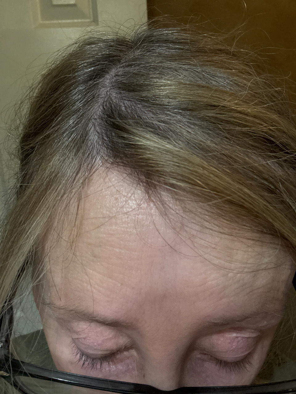 The Hair Pill review photo by Peggy H.