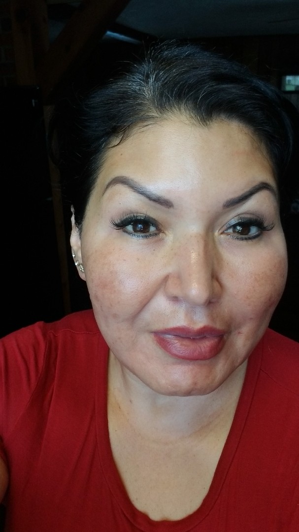 The Spot Cream review photo by Janeth Z.