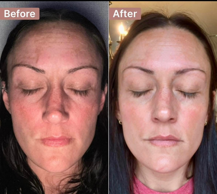 Customer photo