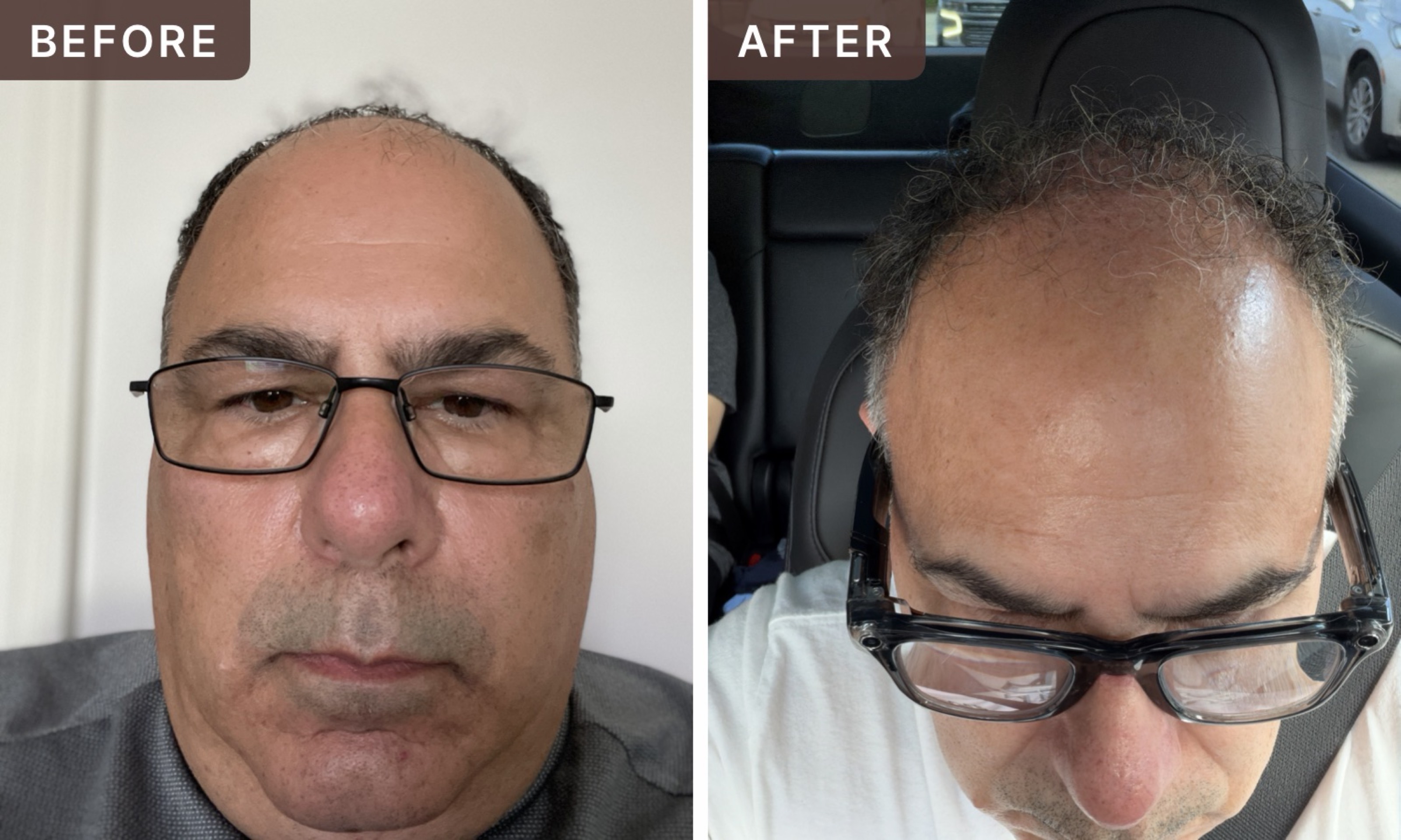 Michael C. -- before and after, 8 weeks
