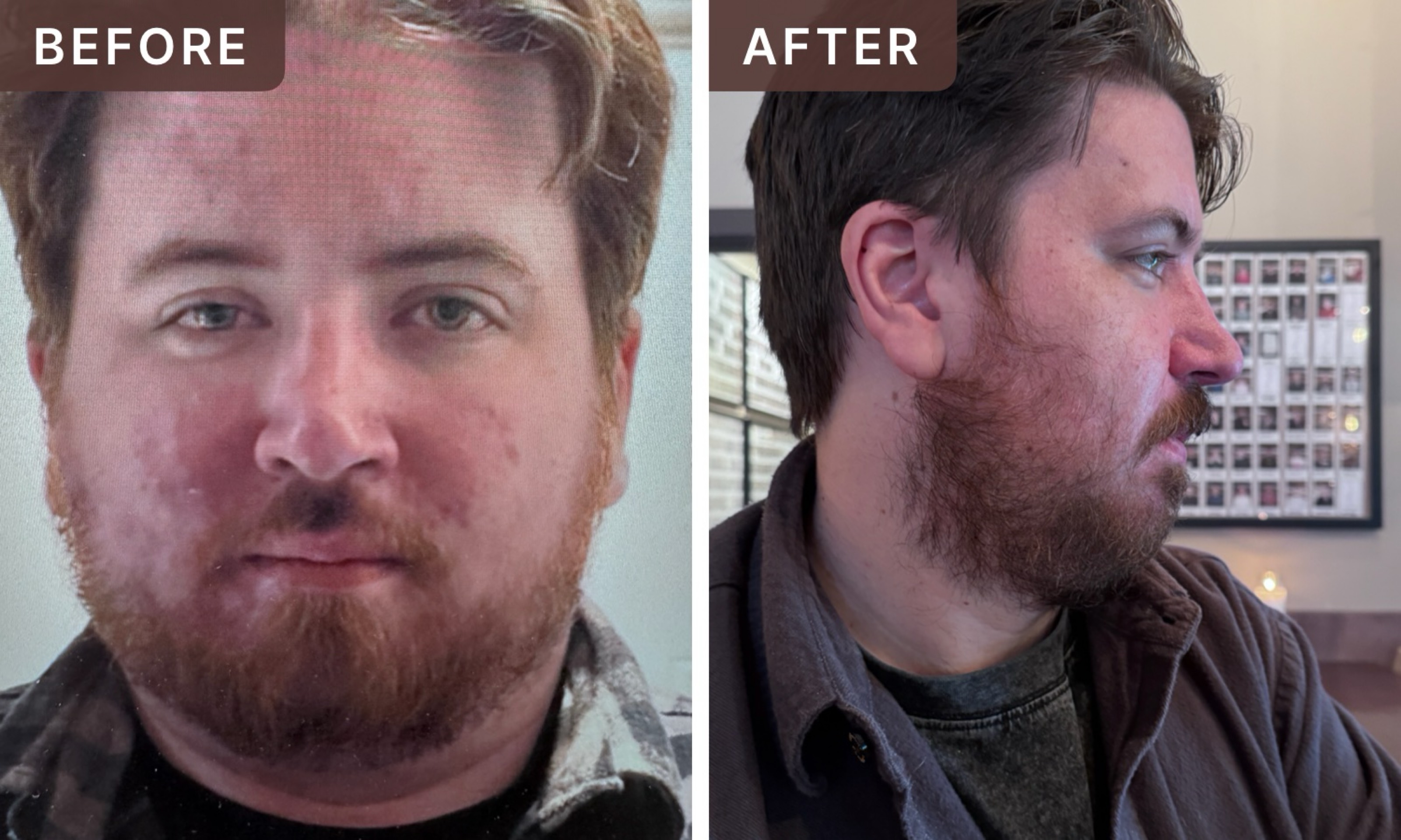 Tyler Q. -- before and after, 8 weeks