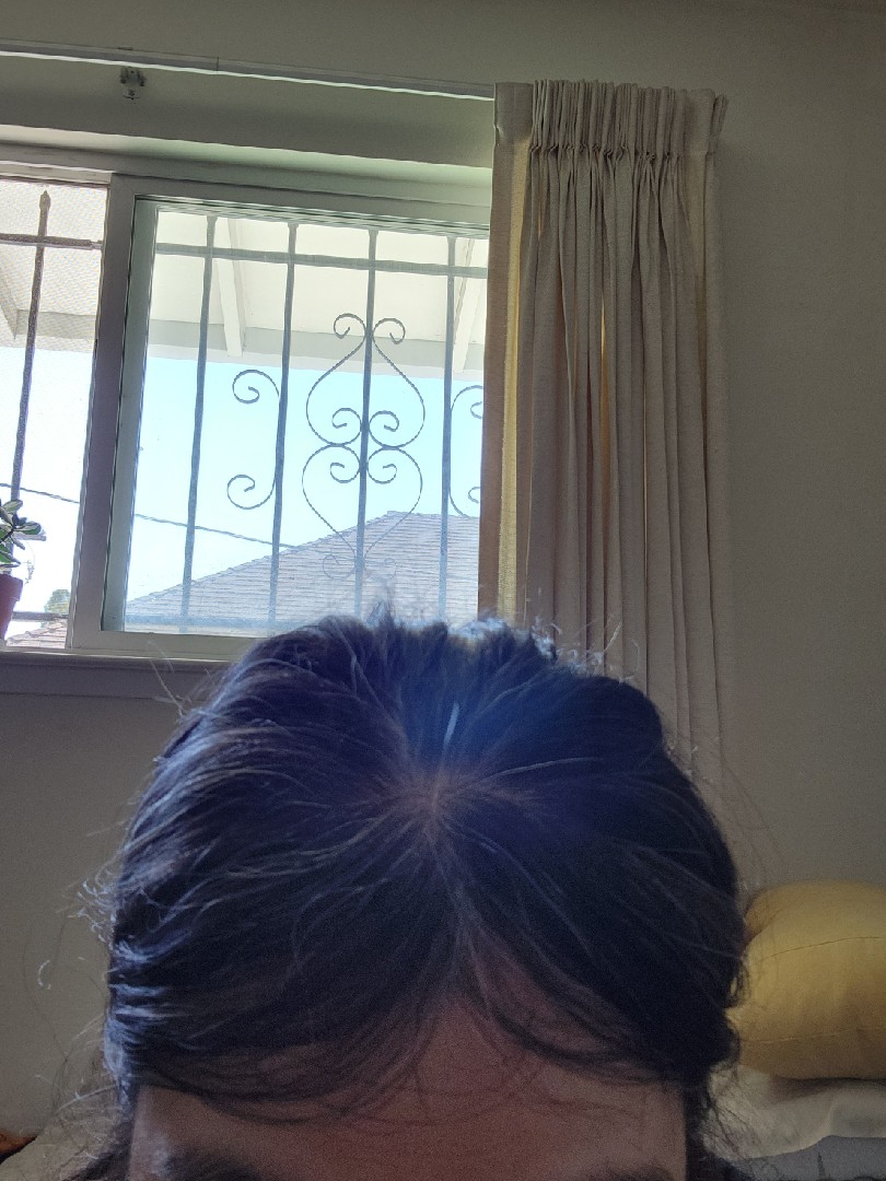 The Hair Topical Solution - Classic review photo by Lucina S.