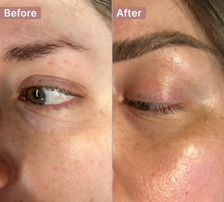 The Eye Serum review photo by Heather R.
