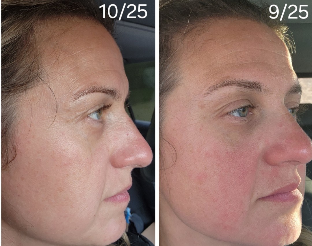 The Anti-Aging Cream review photo by Ashley L.