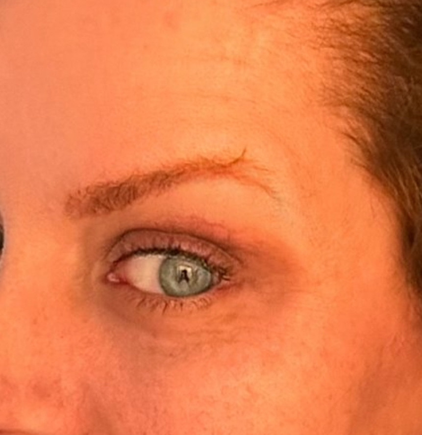 The Eye Serum review photo by Carolyn  F.