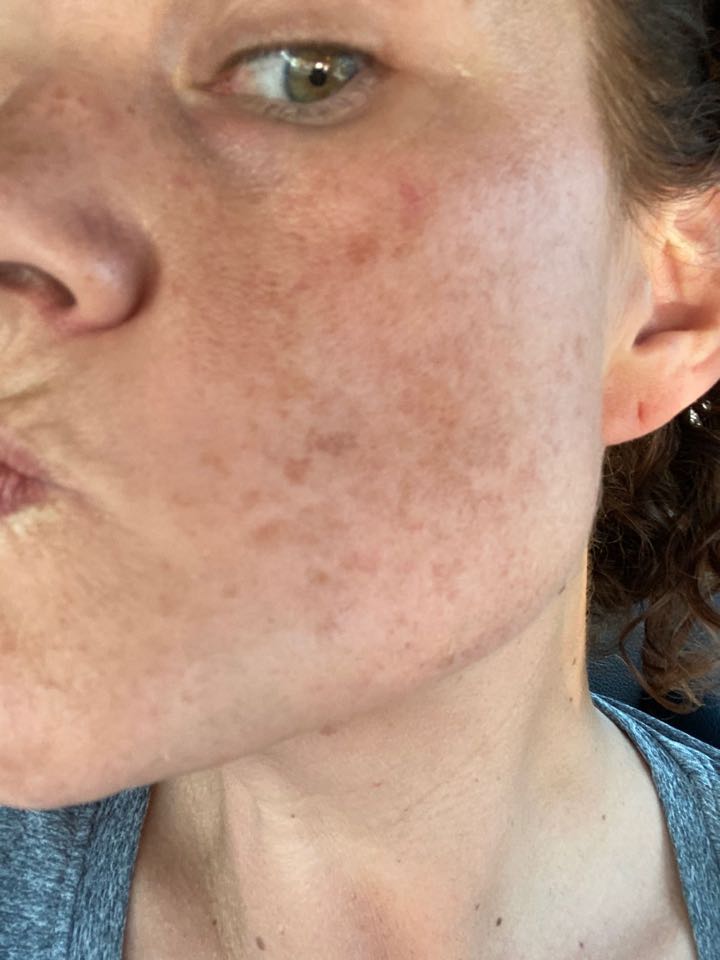 The Spot Cream review photo by Angela S.