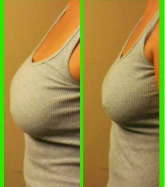 musely it works wraps breast lift