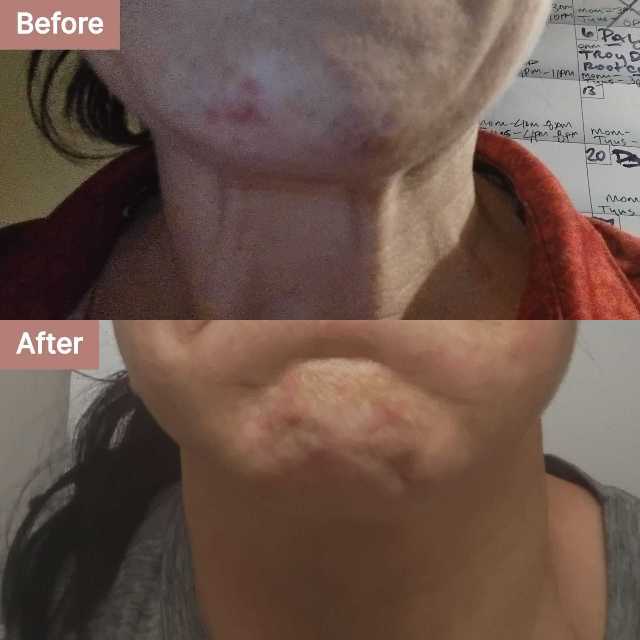 Charlotte B.'s story