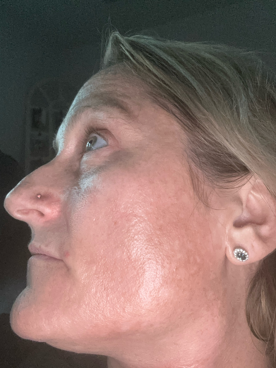 The Spot Cream review photo by Angela F.
