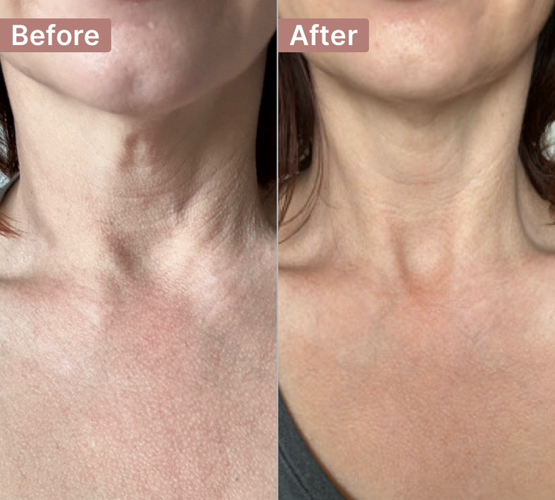 The Neck Cream review photo by Rachael F.
