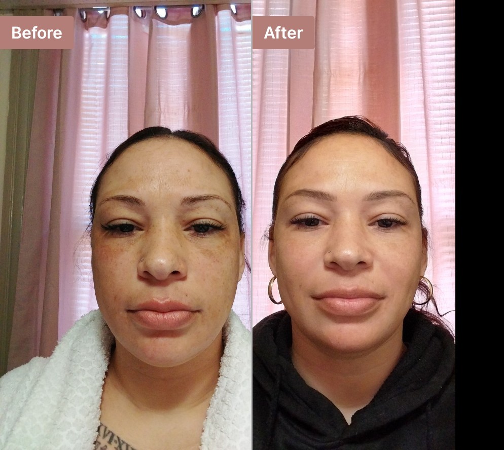 The Spot Cream review photo by Jessica  S.