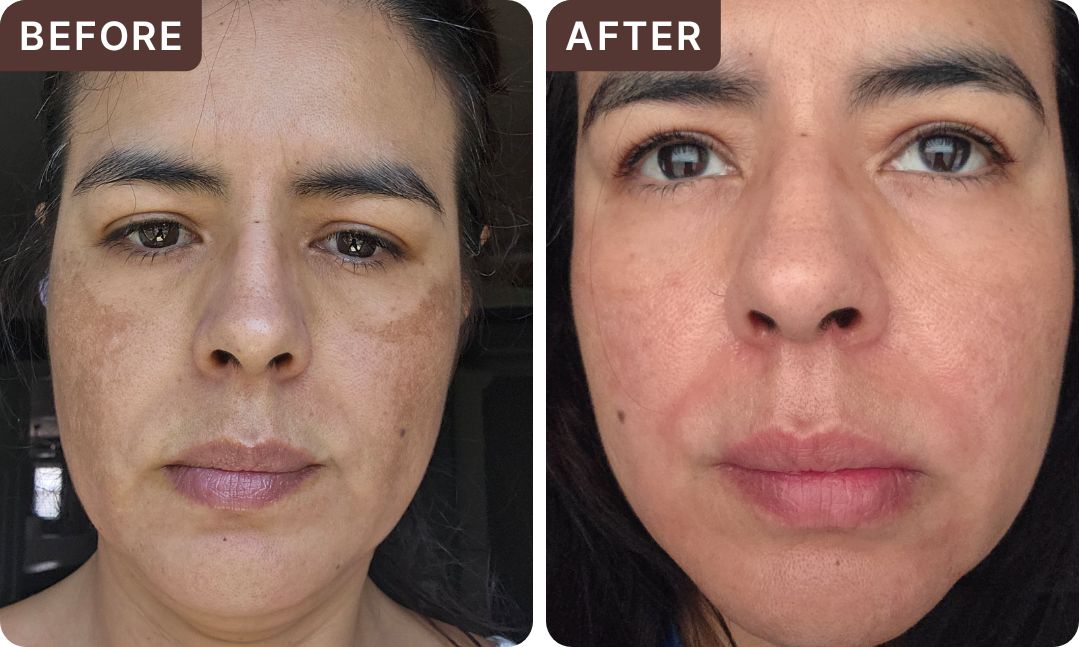 KARINA D. -- before and after, 8 weeks
