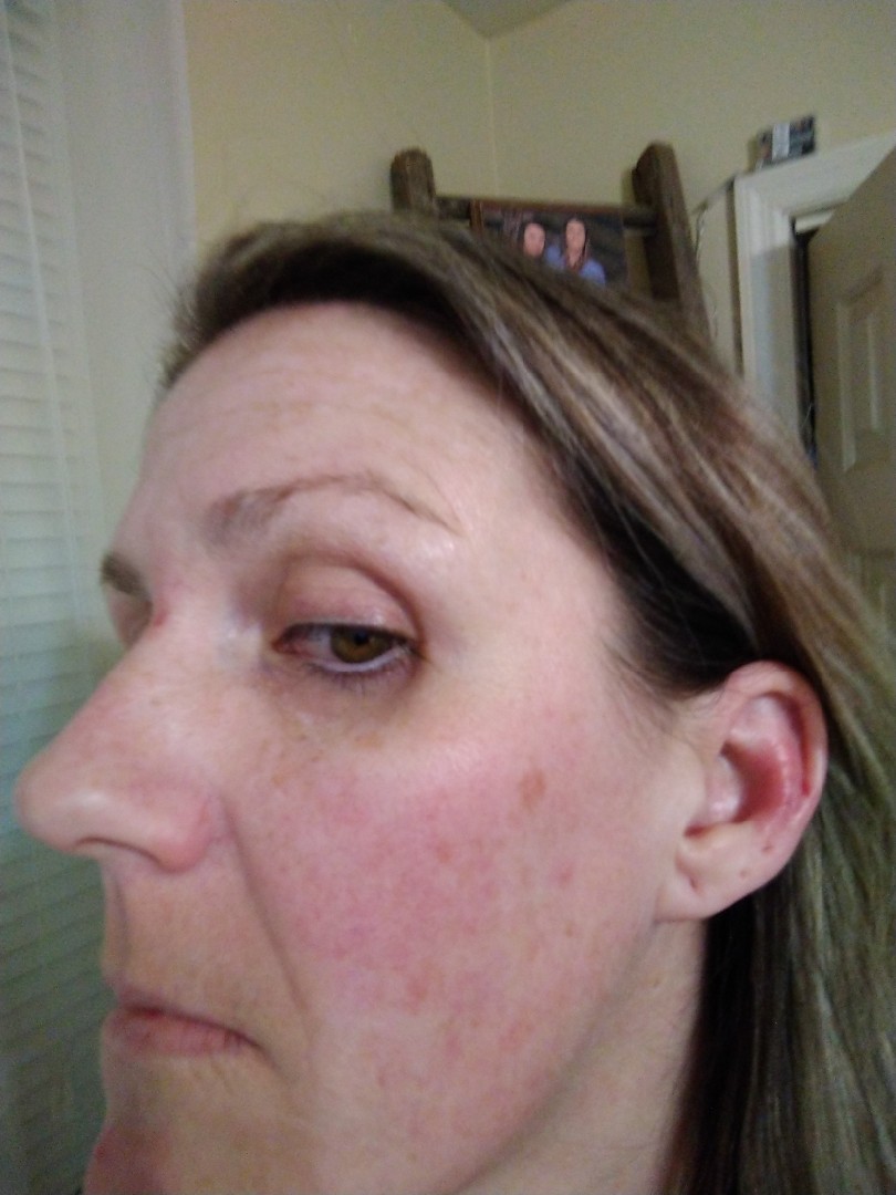 The Spot Cream review photo by Trish L.