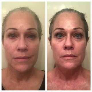 The Anti-Aging Cream review photo by Julie B.