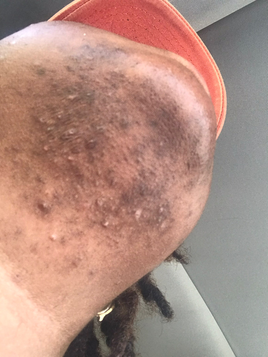The Spot Cream review photo by Alison B.