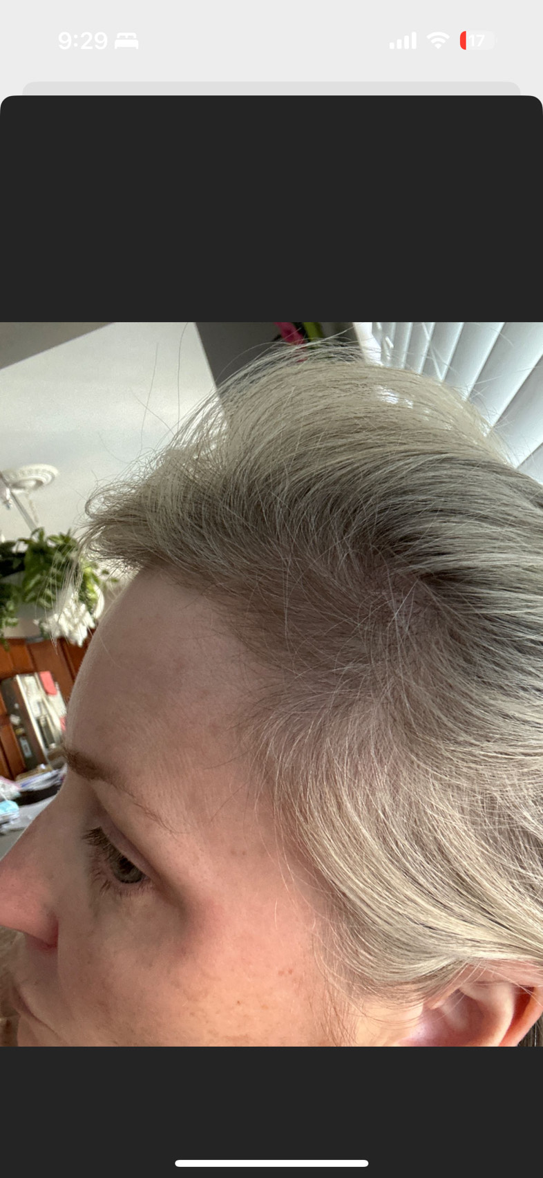The Hair Pill review photo by Nicole H.