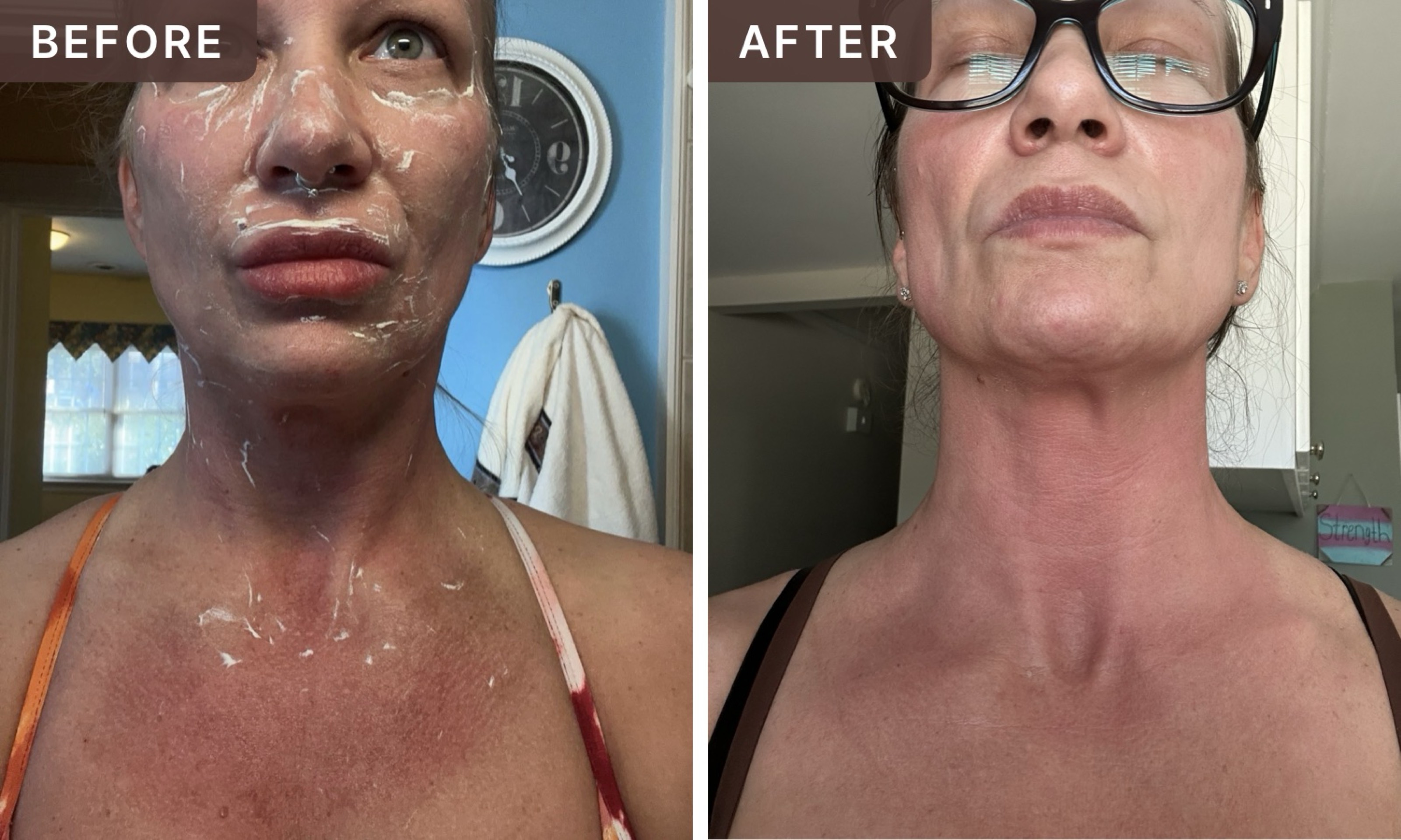🐞Bridget🐝 N. -- before and after, 8 weeks