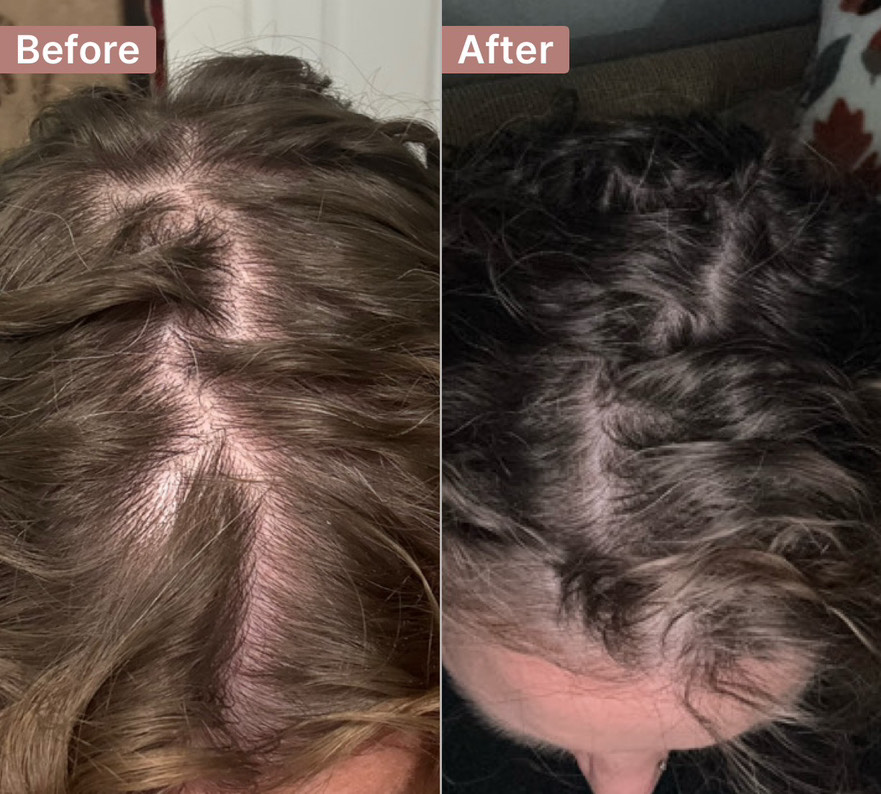 The Hair Pill review photo by Laura K.