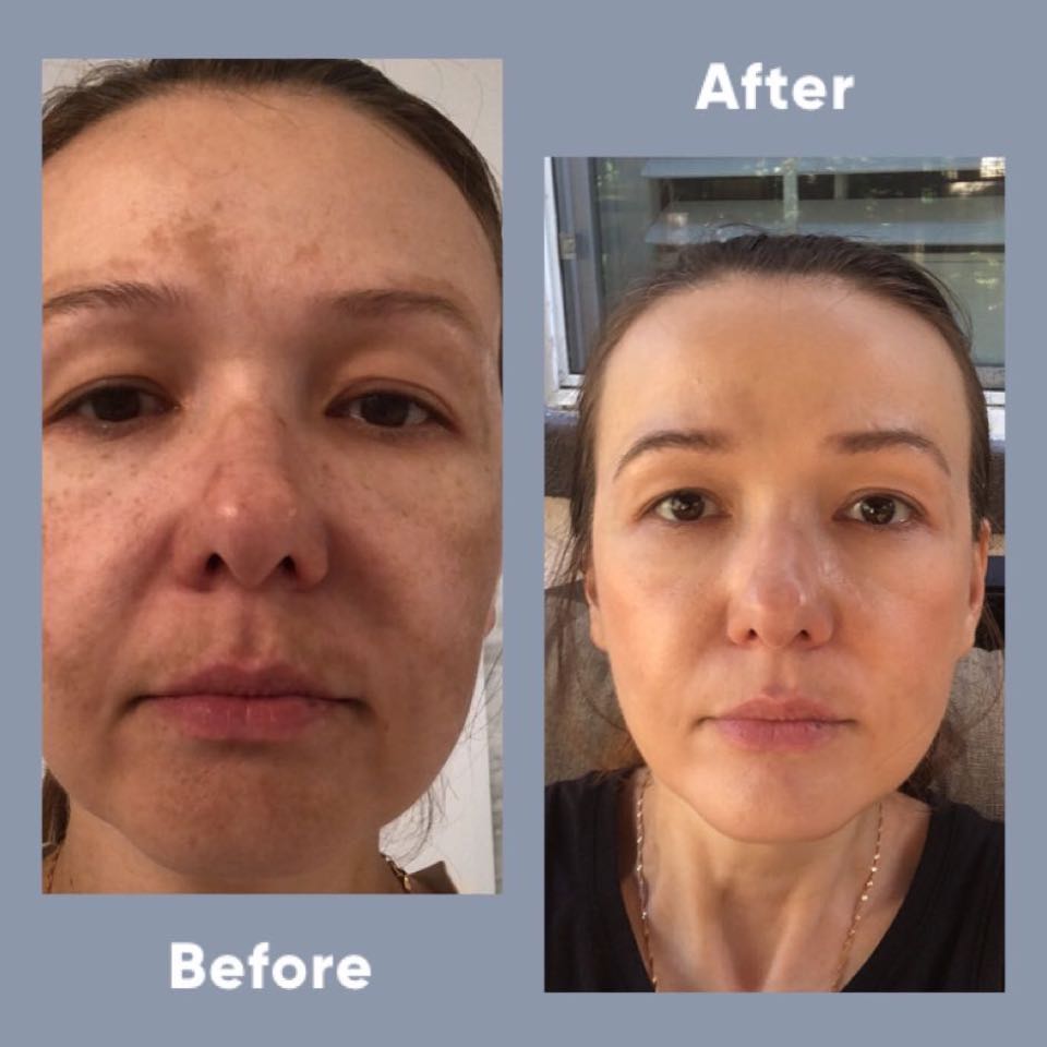 The Spot Cream review photo by Olena S.