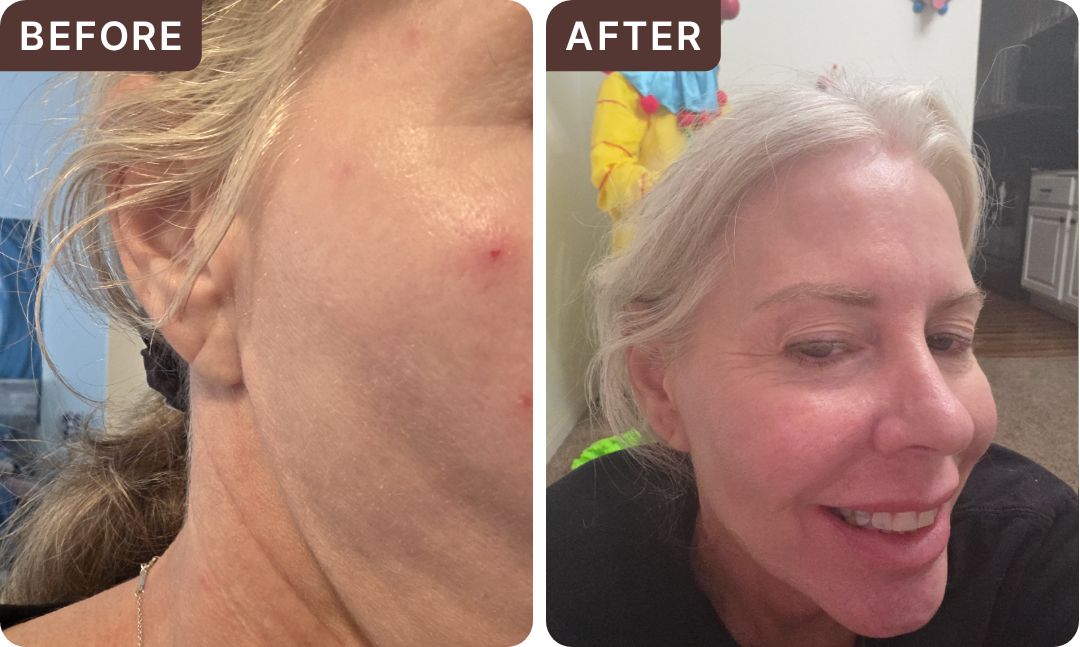 Christina b. -- before and after, 8 weeks
