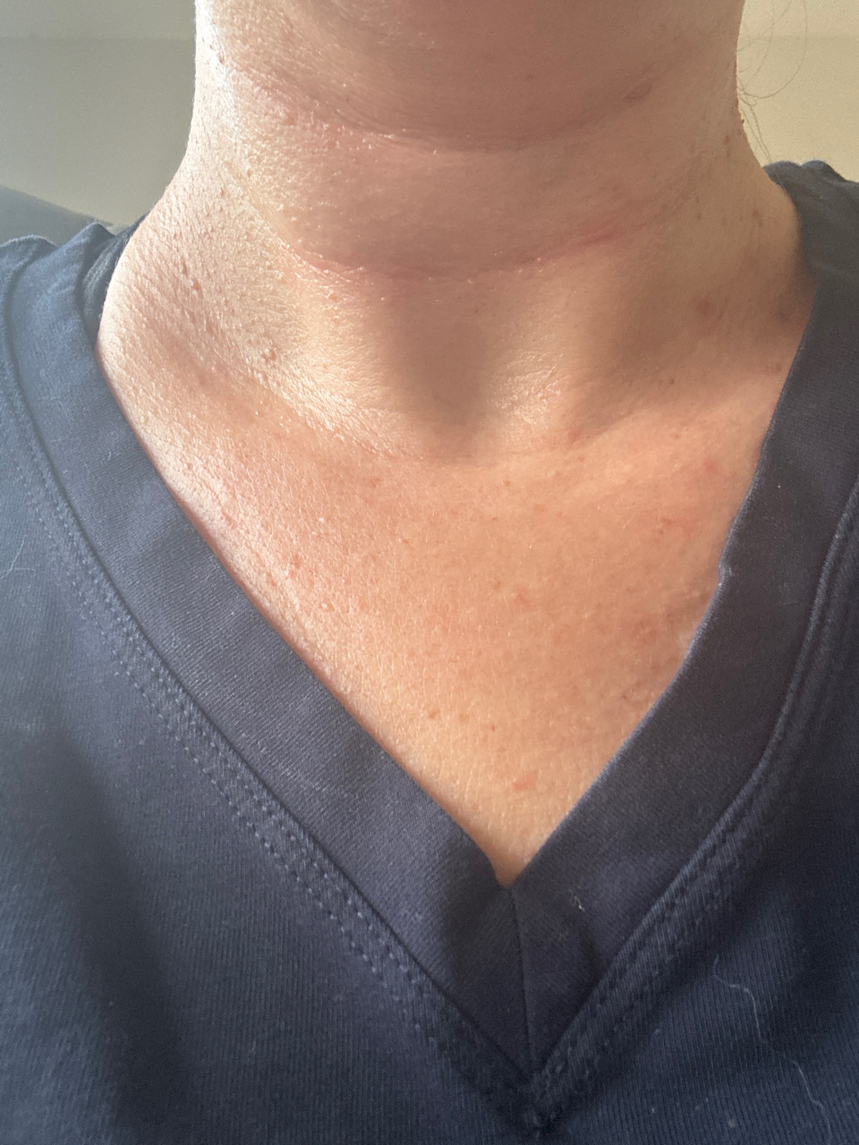 The Neck Cream review photo by Mary M.