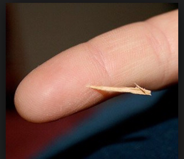 Заноза 4. Заноза 4. Заноза 4. Заноза 4. Заноза 4.