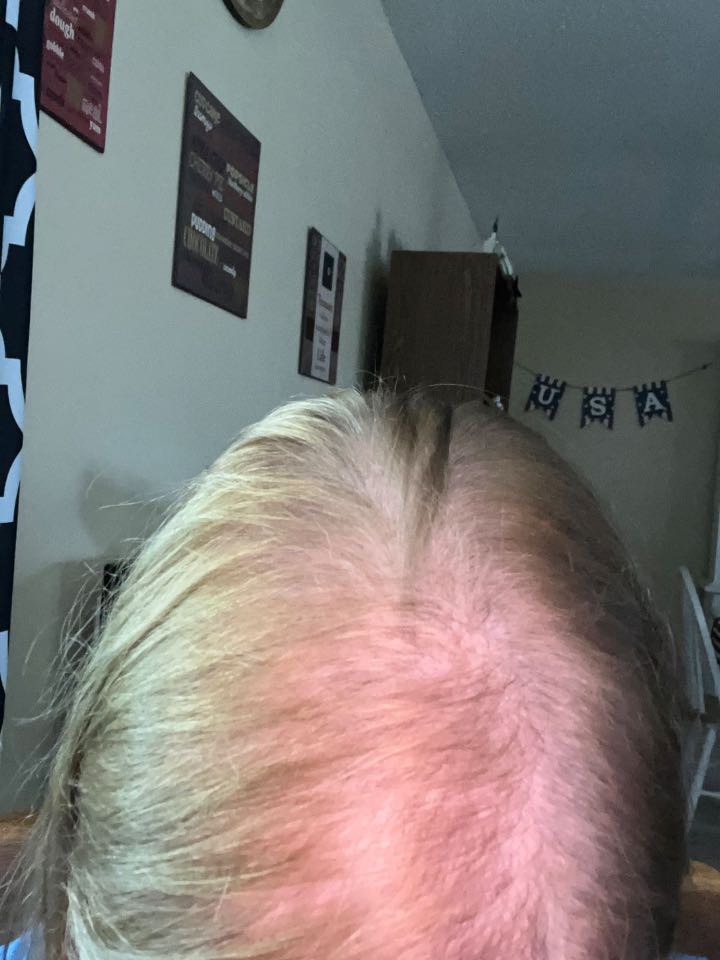 The Hair Topical Solution - Classic review photo by Rhonda J.