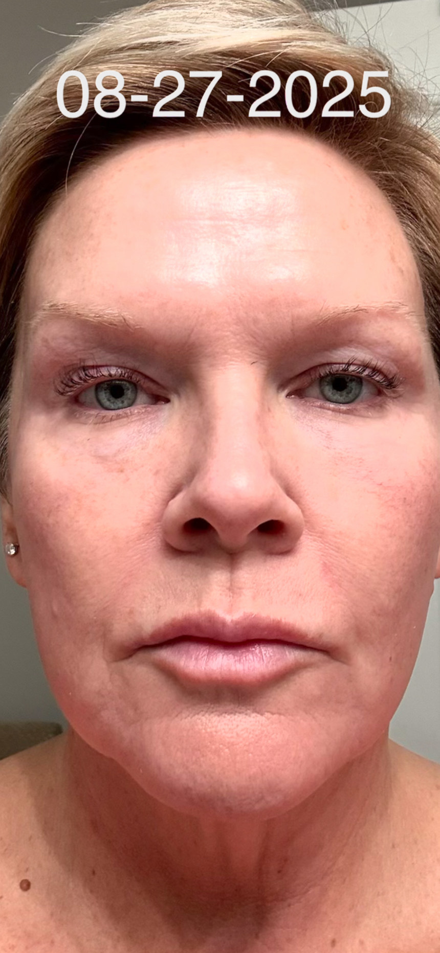 The Anti-Aging Cream review photo by Melissa R.